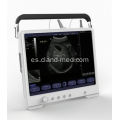 Escáner de ultrasonido portátil Digital Ultrasound Machine Price